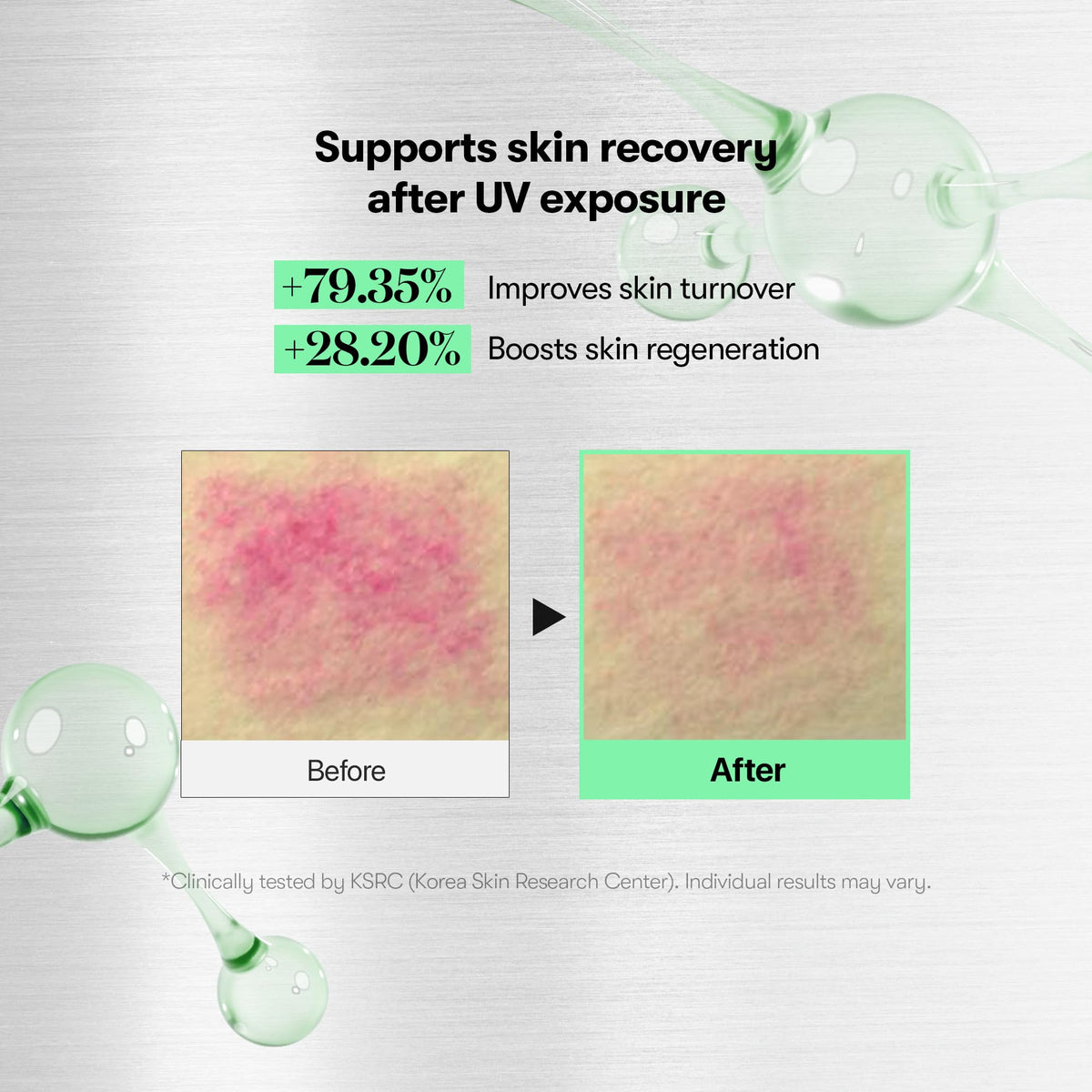 VT COSMETICS CICA Reedle Shot 700 Microneedling Serum application on skin