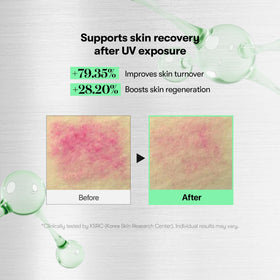 VT COSMETICS CICA Reedle Shot 700 Microneedling Serum application on skin