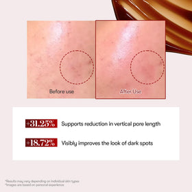 VT COSMETICS Red support Reedle Shot Serum packaging