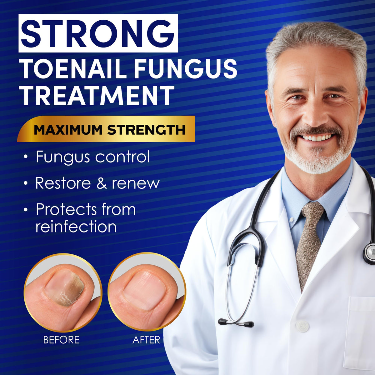 VTROUY Toenail Fungus Extra Strength close-up of bottle