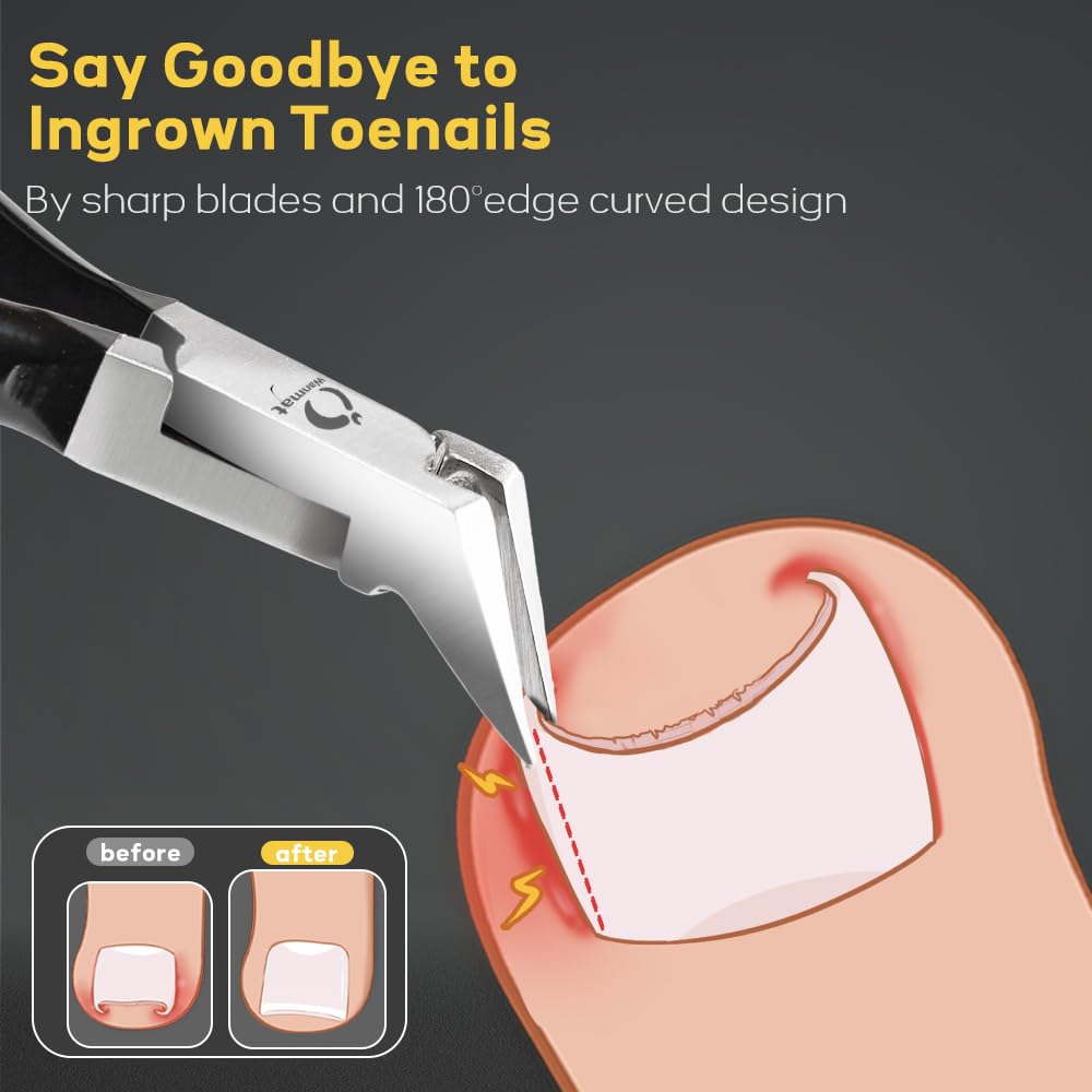 Wanmat Toenail Clippers with nail catcher feature
