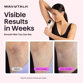Wavytalk IPL Hair Removal Device side view showing control panel