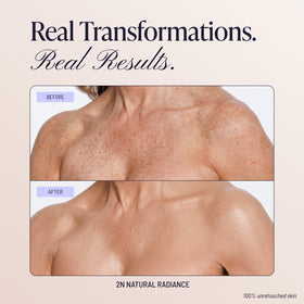 Westmore Beauty Body Coverage Perfector 2N Natural Radiance on model's skin