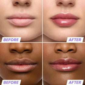 Wonderskin Lip Oil Rehab Serum applicator close-up