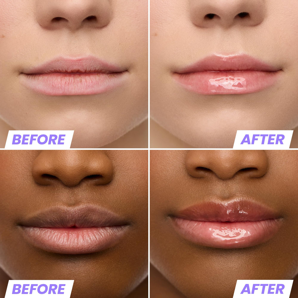 Wonderskin Lip Oil Rehab Serum applied on lips for a glossy look
