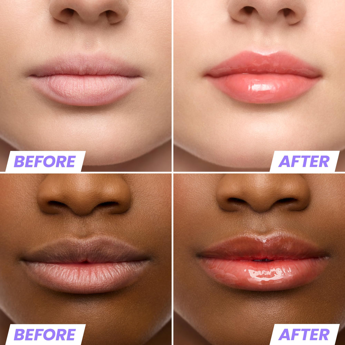 Wonderskin Lip Oil Rehab Serum packaging side view