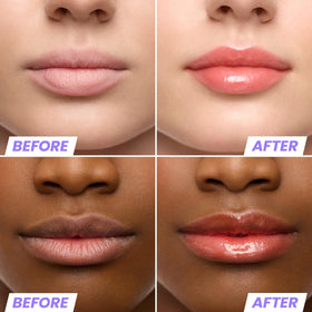 Wonderskin Lip Oil Rehab Serum packaging side view
