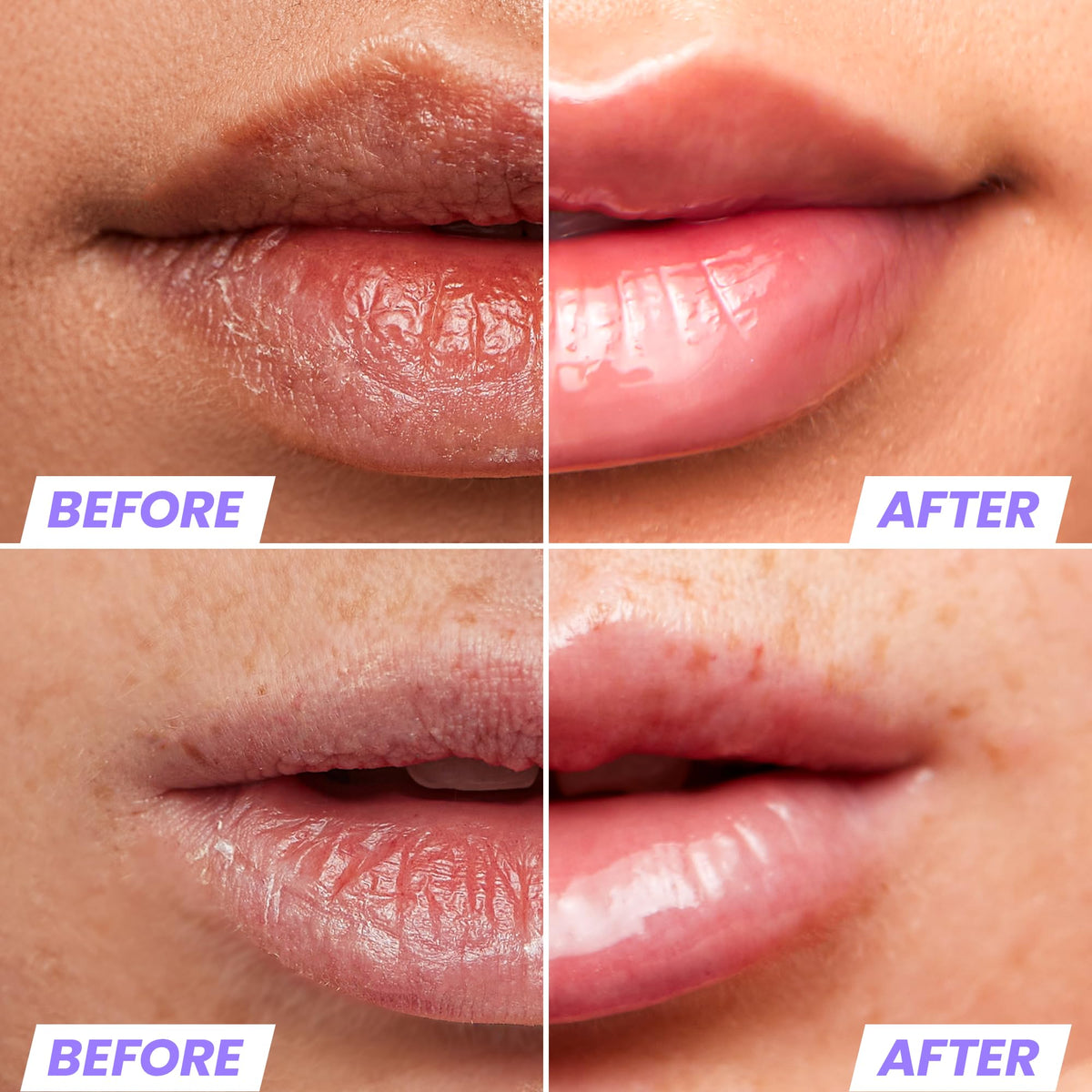 Wonderskin Lip Oil Rehab Serum packaging with glossy finish