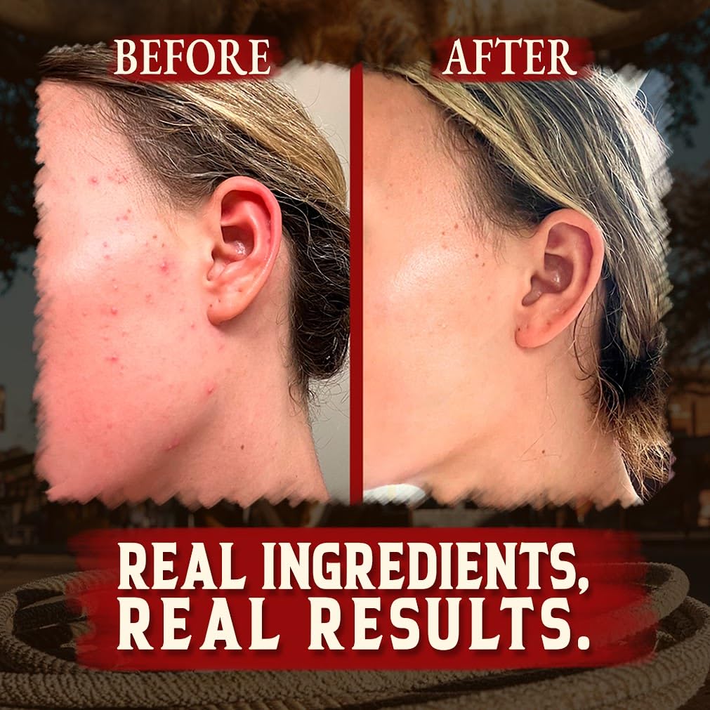 Wrath & Remedy Organic Beef Tallow Whipped Honey Balm in use on skin