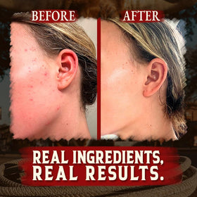 Wrath & Remedy Organic Beef Tallow Whipped Honey Balm in use on skin