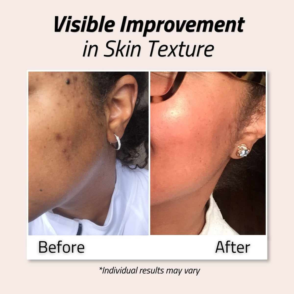YEOUTH Glycolic Acid Toner 8% in a bathroom setting