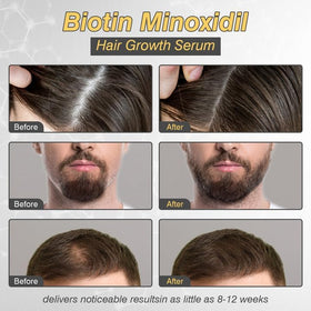 YKDILYHH Minoxidil Hair Growth Serum 5% ingredients list