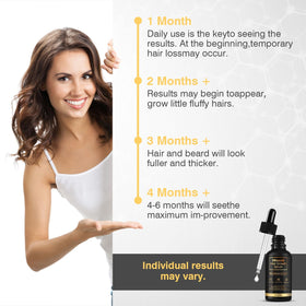 YKDILYHH Minoxidil Hair Growth Serum 5% lifestyle use