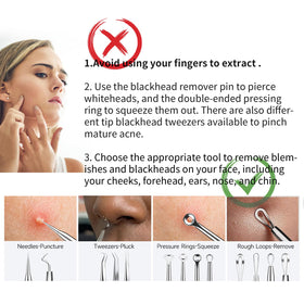 YOUYISI blackhead tweezers close-up