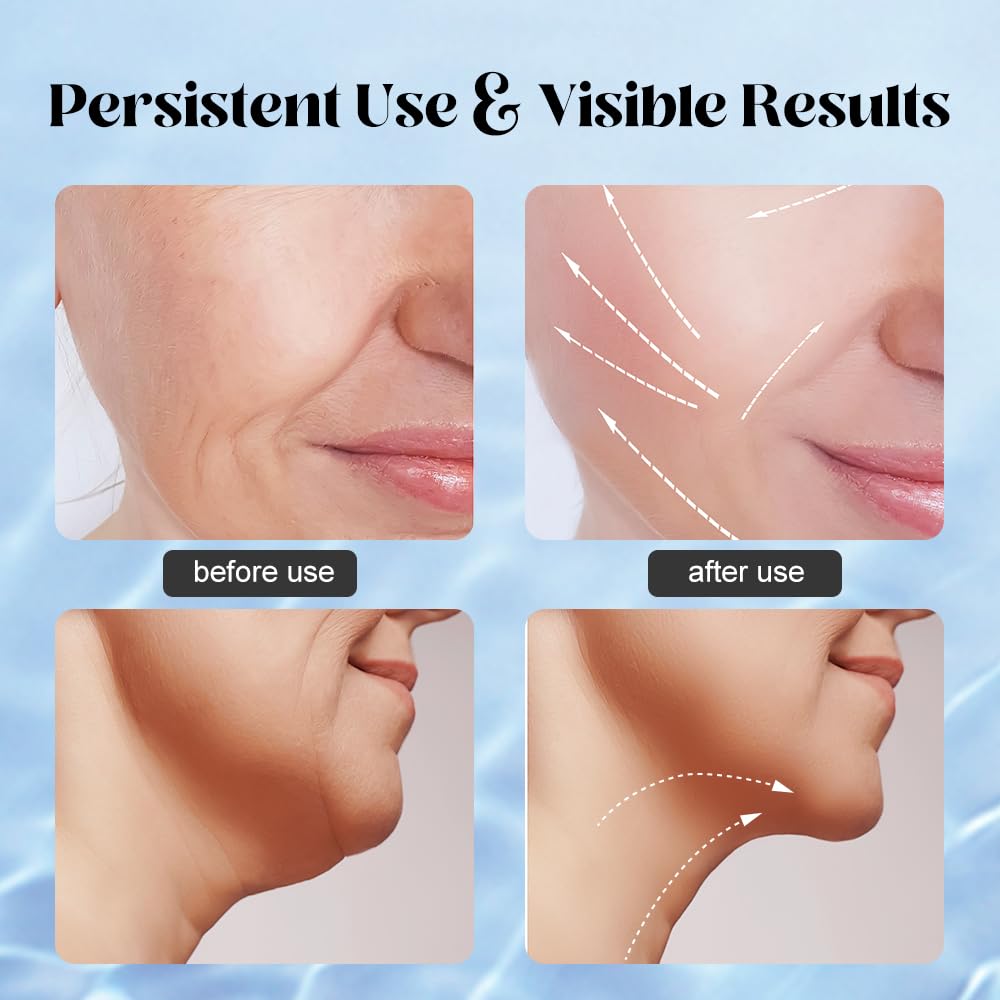 YUNRUO Neck Face Massager Tool with silver sensing rings close-up