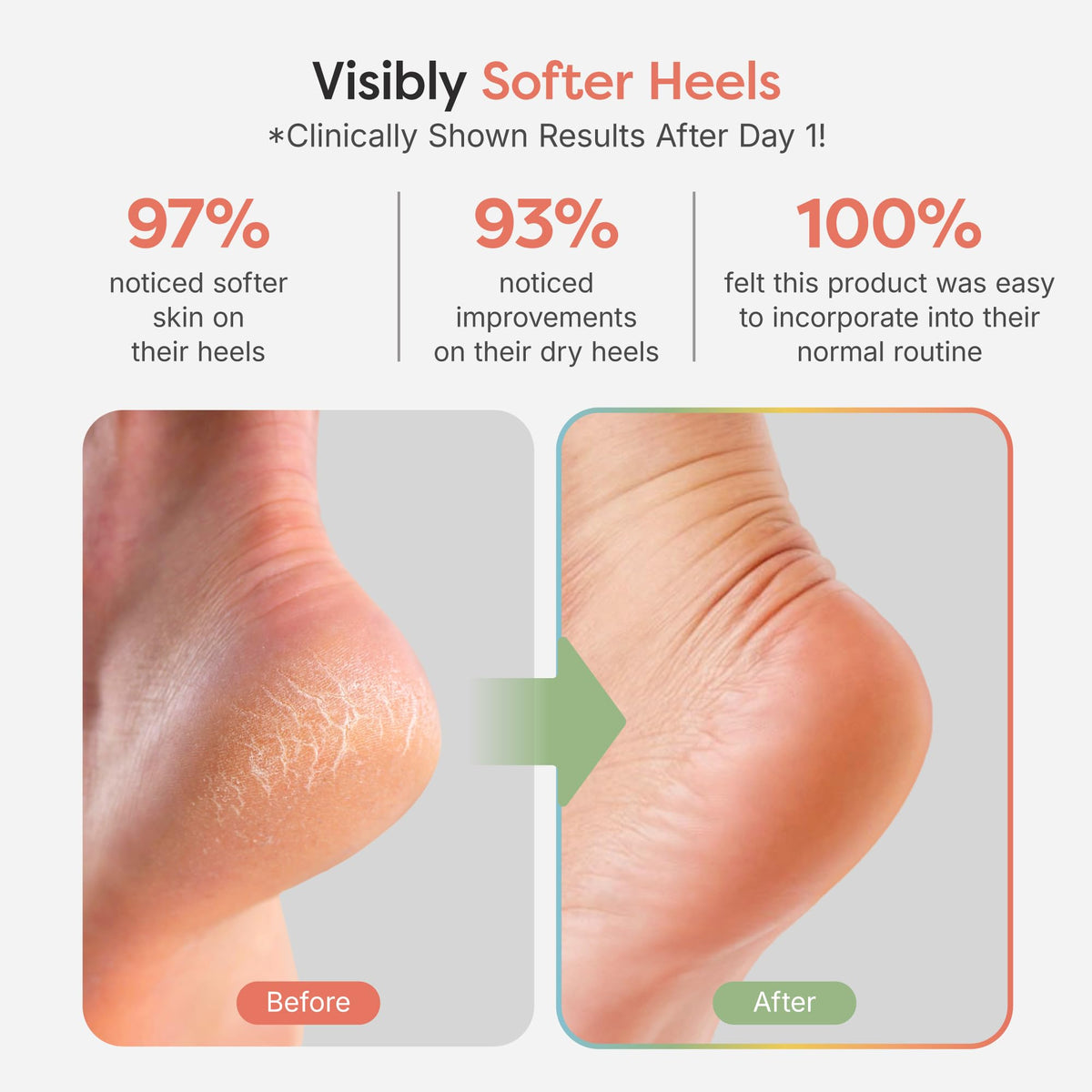 ZenToes Moisturizing Heel Socks in packaging