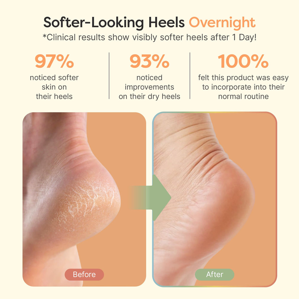 ZenToes Moisturizing Heel Socks in packaging