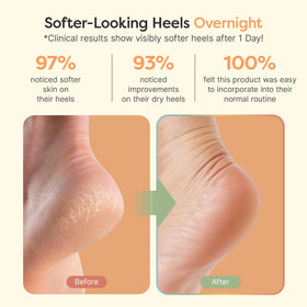 ZenToes Moisturizing Heel Socks in packaging