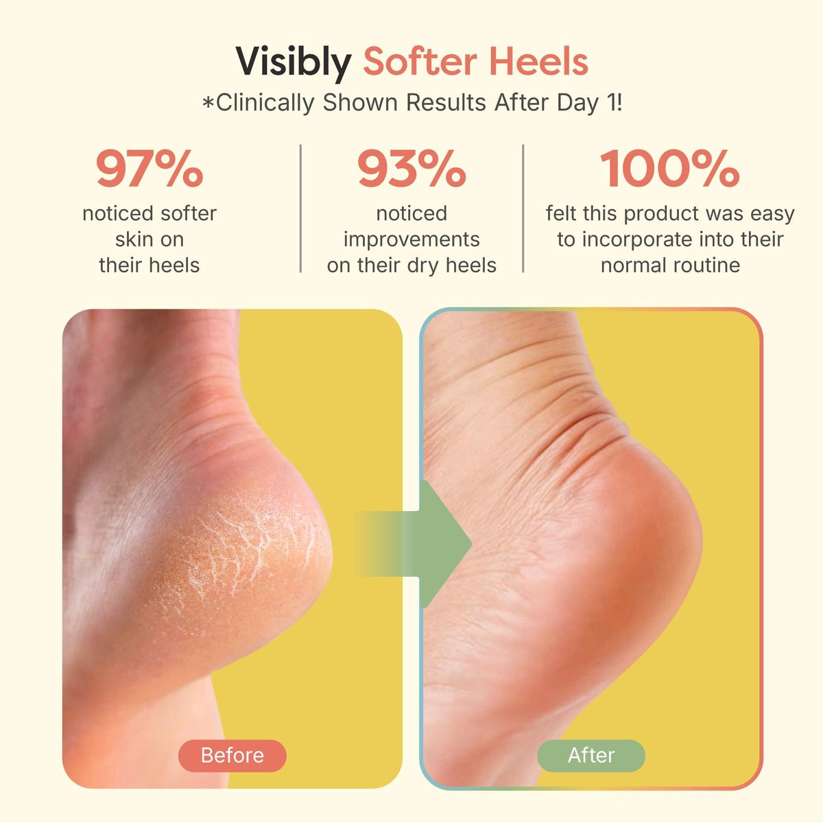 ZenToes Moisturizing Heel Socks in packaging