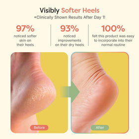 ZenToes Moisturizing Heel Socks in packaging