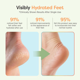 ZenToes Moisturizing Heel Socks in packaging with product details