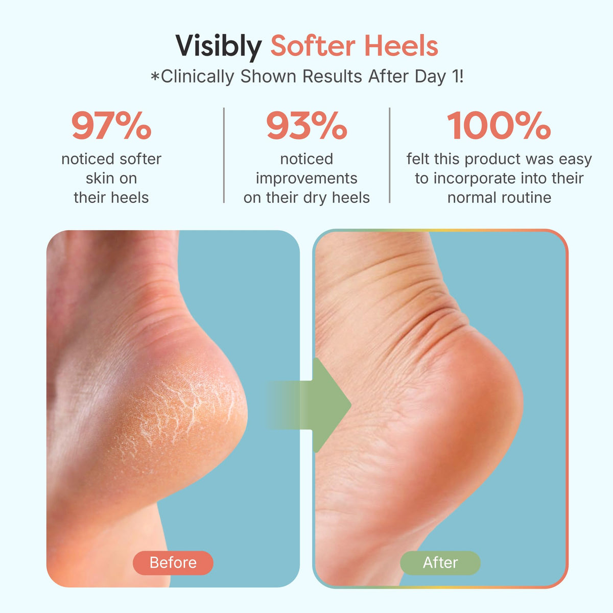 ZenToes Moisturizing Heel Socks in plush fabric close-up