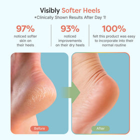 ZenToes Moisturizing Heel Socks in plush fabric close-up