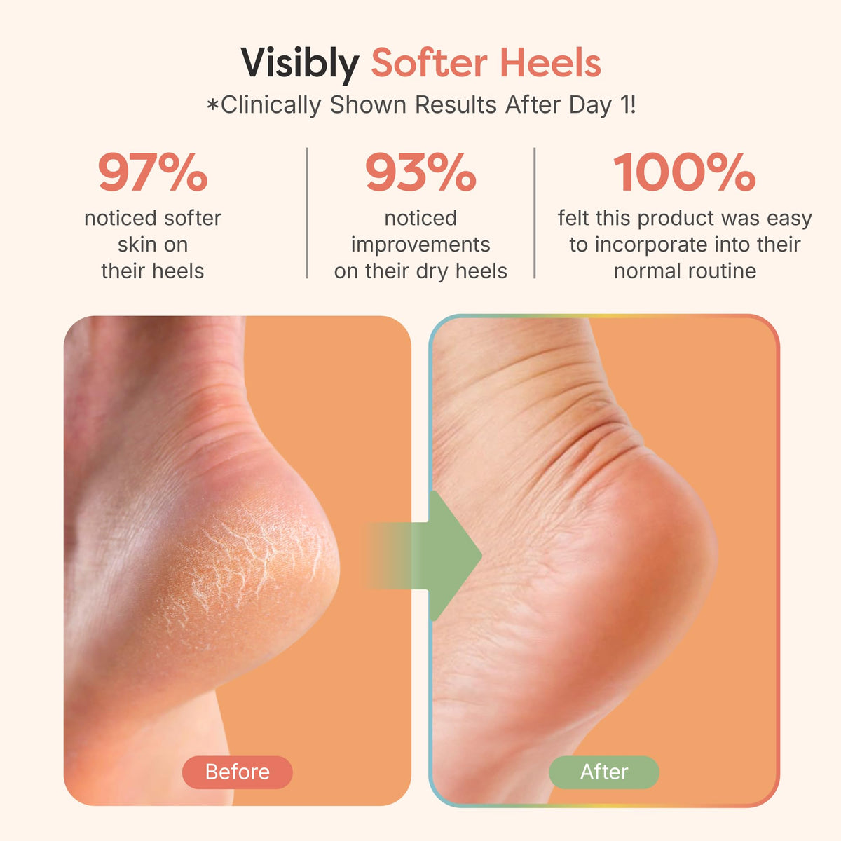 ZenToes Moisturizing Heel Socks in use on feet