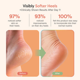 ZenToes Moisturizing Heel Socks in use on feet