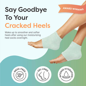 ZenToes Moisturizing Heel Socks open-toe design for breathability