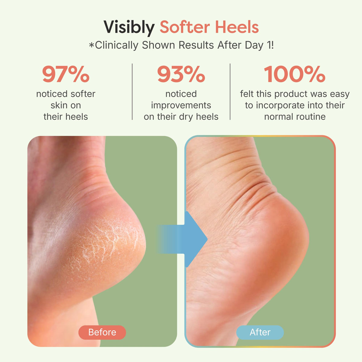 ZenToes Moisturizing Heel Socks with jojoba oil and vitamin E infusion