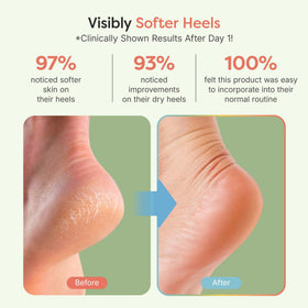 ZenToes Moisturizing Heel Socks with jojoba oil and vitamin E infusion