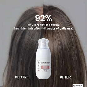 Zephta H-Regrow Hair Growth Spray packaging details