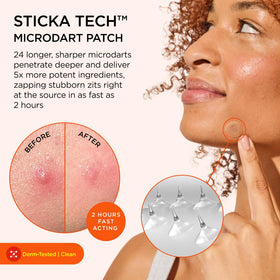 ZitSticka Killa Acne Extra Strength Microdart Pimple Patch with swab
