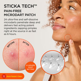 ZitSticka Killa patch close-up showing microdarts